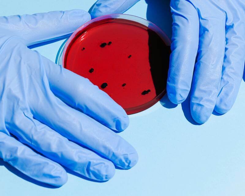 Hoitamaton Kondylooma – Riskit ja seuraukset